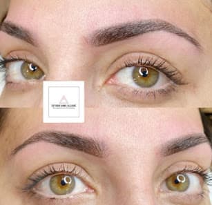 Imagen principal de Anna Alcaide Centro Especializado en Micropigmentación y Microblading en Andorra