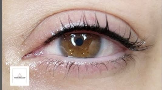 Galería de Anna Alcaide Centro Especializado en Micropigmentación y Microblading en Andorra 2