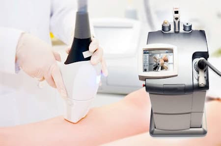 Galería de Centre de depilació làser Bola de Pèl 3